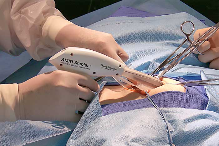 Hernia mesh surgical stapler